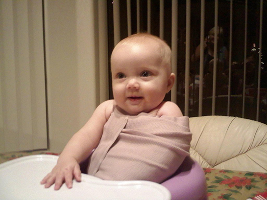 Çocuklarda Kol Çıkması Belirtileri ve Tedavisi