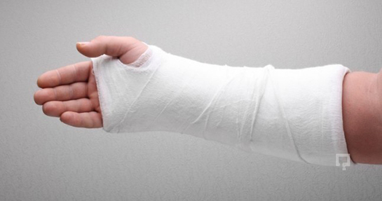 Kırık Kol Belirtileri ve Tedavisi